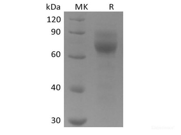 Human Tyrosine-Recombinant Protein kinase receptor UFO/AXL oncogene/UFO (C-6His)