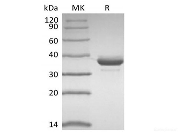 Recombinant Human CD81 (N-FC)