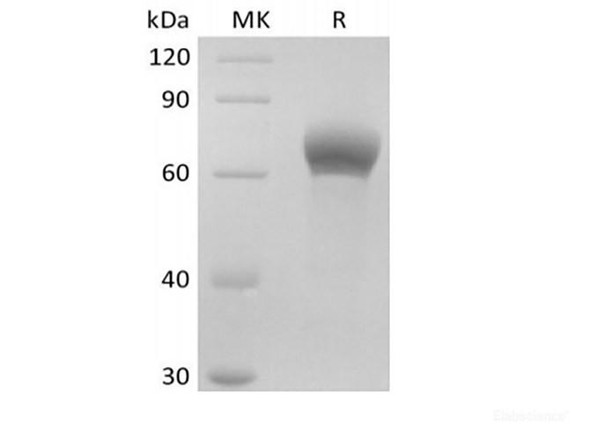 Human Dickkopf-Related Recombinant Protein 1/DKK-1 (C-Fc)