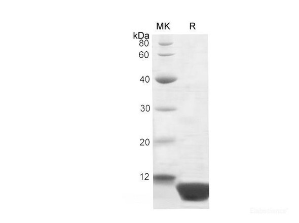 Human Recombinant Protein S100P Recombinant Protein (His Tag) (RPES6517)