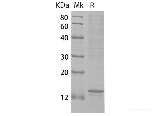 Human CCL22 Recombinant Protein (RPES6556)