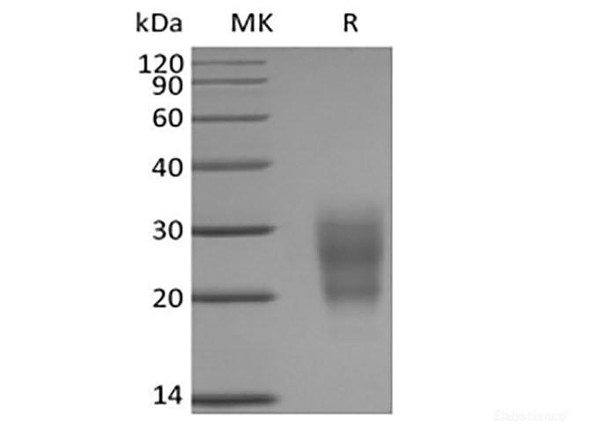 Mouse NKG2-D type II Integral Membrane Recombinant Protein/NKG2D/CD314 (N-6His)