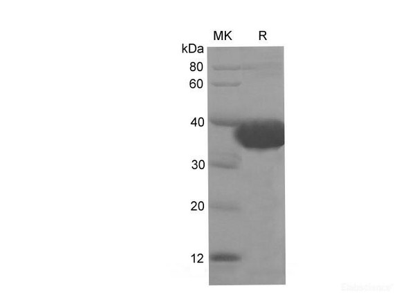 Mouse FAP Recombinant Protein (His Tag) (RPES6750)
