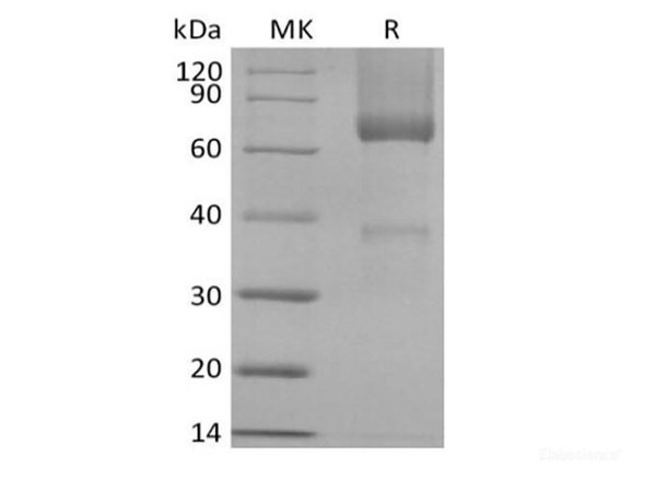 Recombinant Rhesus Macaque Glypican-3/GPC3/OCI5 (C-6His)