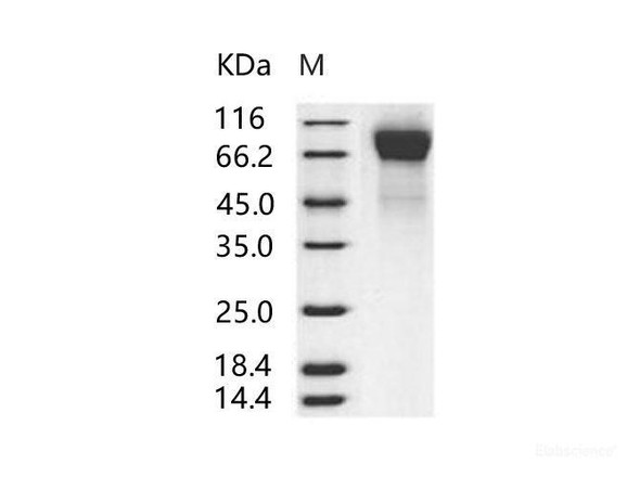 Human RSV (B1) glycoRecombinant Protein G / RSV-G Recombinant Protein (His Tag)