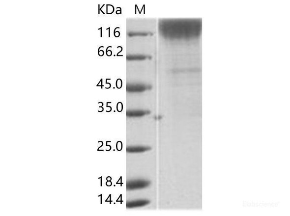 SIV (isolate 216.94.A2) gp120 Recombinant Protein (His Tag)