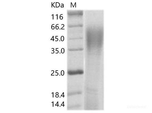 SIV (isolate SIVmac251v31523ru28) envelope glycoRecombinant Protein gp120 Recombinant Protein (His Tag)