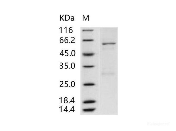 Vaccinia Virus B18R / B19R Recombinant Protein (His Tag)