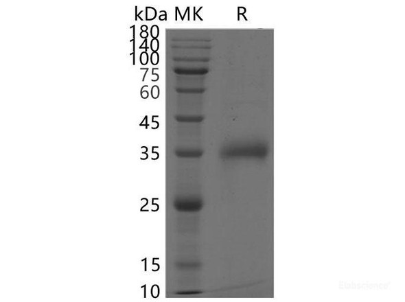 Recombinant SARS-CoV-2 Spike RBD (K417N,E484K,N501Y) (His Tag)