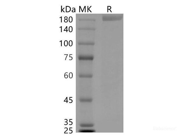 SARS-CoV-2 S-trimer 6P Recombinant Protein