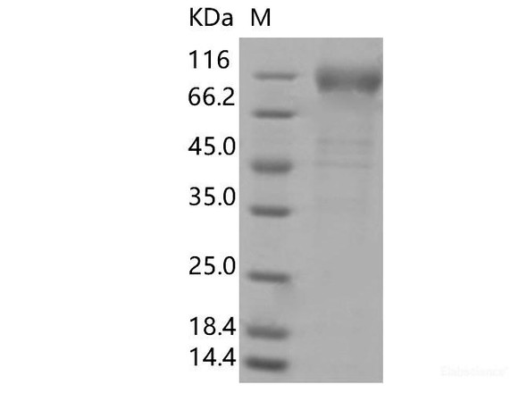 Recombinant SARS-CoV-2 Spike S1(E154K, L452R, E484Q, D614G, P681R) (His Tag)