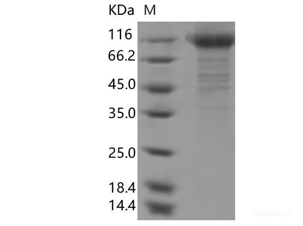 Recombinant SARS-CoV-2 Spike S1(N234Q) (His Tag)