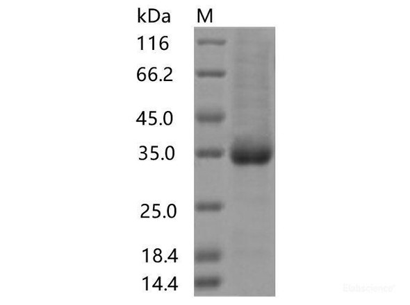 Recombinant SARS-CoV-2 Spike RBD (S477I) (His Tag)