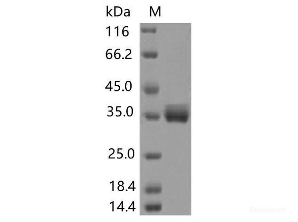 Recombinant SARS-CoV-2 Spike RBD (T385A) (His Tag)