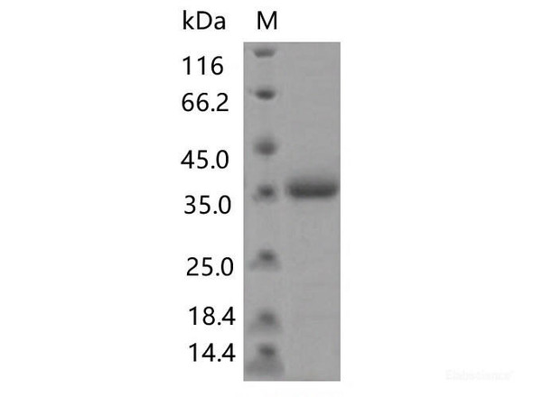 Recombinant SARS-CoV-2 Spike RBD (N481D) (His Tag)