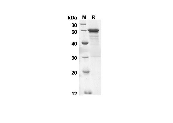 Recombinant Human CANX Protein(Gst Tag) (RPES8007)