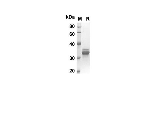 Recombinant Human CCL25 Protein(Trx Tag) (RPES8010)