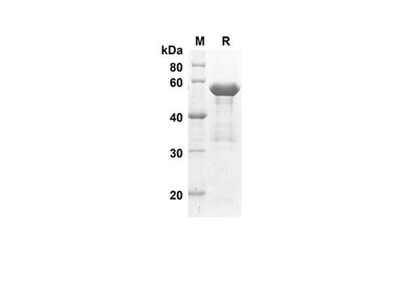 Recombinant Human ACE2 Protein(Sumo Tag) (RPES8017)
