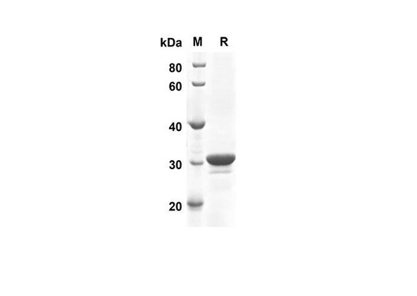 Recombinant Human MAP1LC3B Protein(Sumo Tag) (RPES8020)