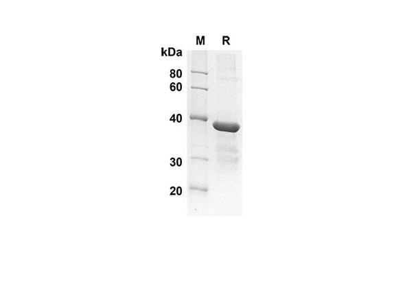Recombinant Human GROÂ²/CXCL2 Protein(Gst Tag) (RPES8027)