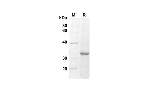 Recombinant Human AGRP Protein(Trx Tag) (RPES8029)