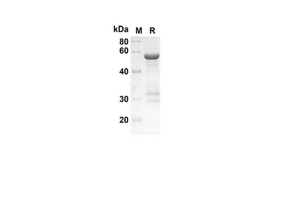 Recombinant Human HSPA1A Protein(Trx Tag) (RPES8044)