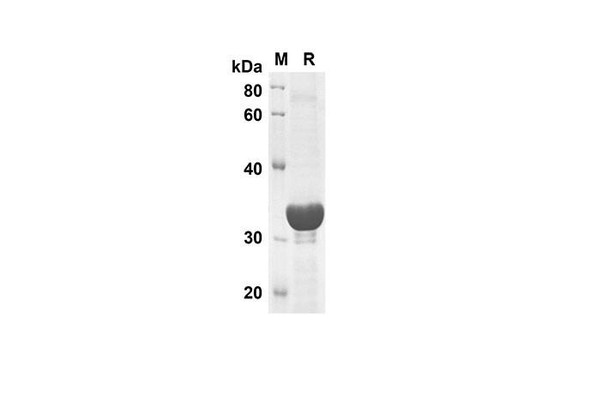 Recombinant Human TNF-Â± Protein(Trx Tag) (RPES8051)