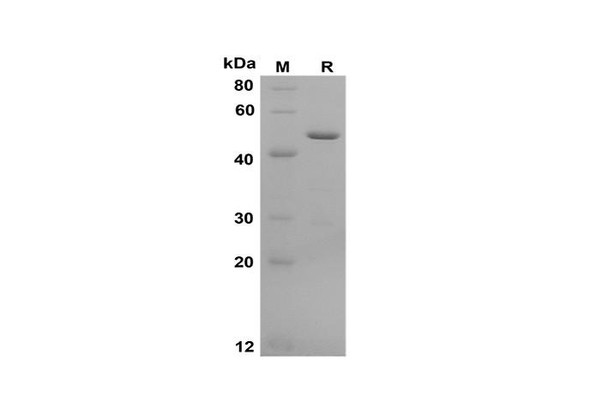 Recombinant Human Galectin-3 Protein(Gst Tag) (RPES8086)