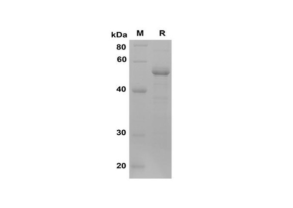 Recombinant Human HTRA1 Protein(Sumo Tag) (RPES8088)