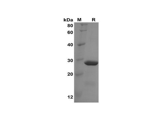 Recombinant Human NUCB2 Protein(Trx Tag) (RPES8089)