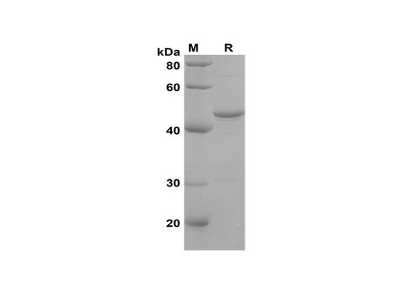 Recombinant Human AIF1 Protein(Gst Tag) (RPES8116)
