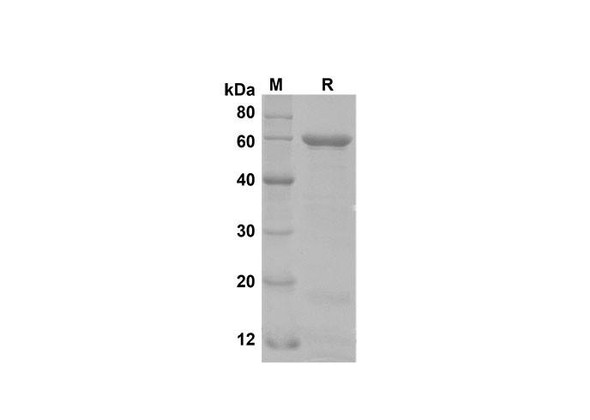 Recombinant Human APOA4 Protein(Sumo Tag) (RPES8113)