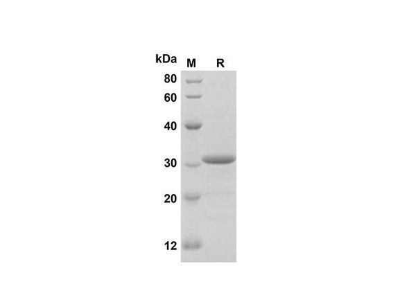 Recombinant Human NLRP3 Protein(Sumo Tag) (RPES8127)