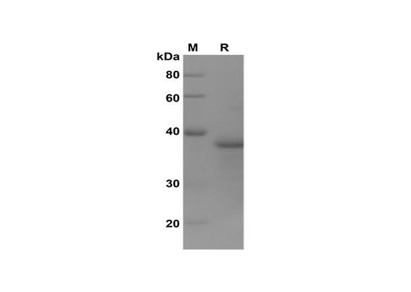 Recombinant Human MLKL Protein(Trx Tag) (RPES8134)