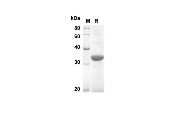Recombinant Mouse IL-21 Protein(Sumo Tag) (RPES8147)
