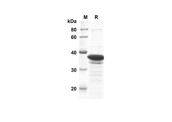 Recombinant Mouse Synapsin-1 Protein(Trx Tag) (RPES8148)