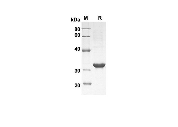 Recombinant Mouse CCL6/C10 Protein(Trx Tag) (RPES8172)