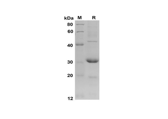 Recombinant Mouse CCL2/JE/MCP-1 Protein(Trx Tag) (RPES8175)