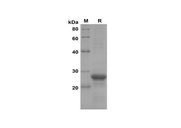Recombinant Mouse CXCL2/MIP-2 Protein(Sumo Tag) (RPES8192)