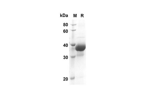 Recombinant Rat CXCI3 Protein(Gst Tag) (RPES8220)