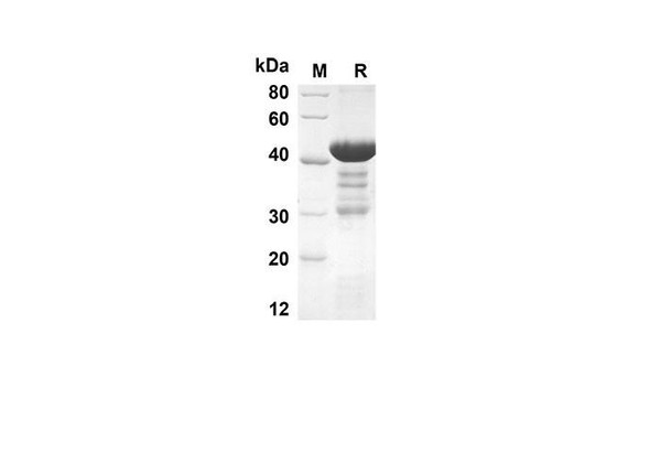 Recombinant Rat GAL1 Protein(GST Tag) (RPES8219)