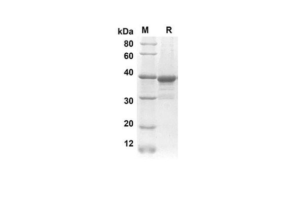 Recombinant Rat CXCL7 Protein(Gst Tag) (RPES8234)
