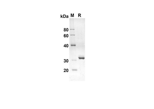 Recombinant Rat I-PTH Protein(Trx Tag) (RPES8228)