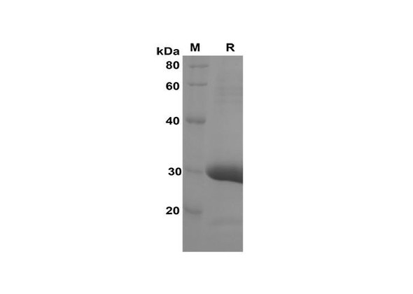 Recombinant Rat CXCL2/CINC-3 Protein(Trx Tag) (RPES8243)