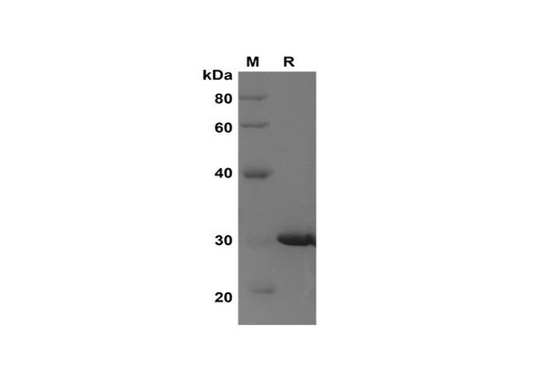 Recombinant Rat MIF Protein(Sumo Tag) (RPES8250)