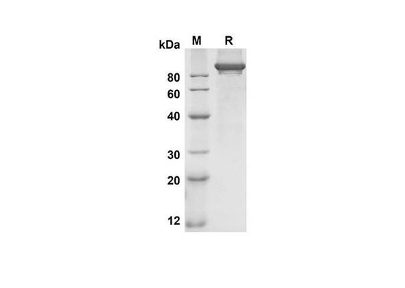 Recombinant Human NRP2 Protein(His Tag) (RPES8252)