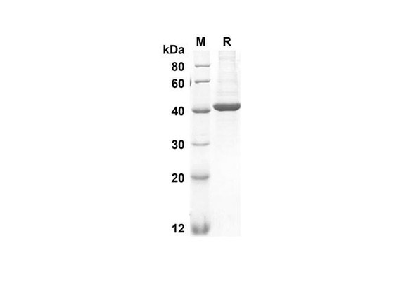 Recombinant Human CHI3L1 Protein(His Tag) (RPES8255)