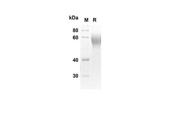 Recombinant Human CRTAM Protein(His Tag) (RPES8279)