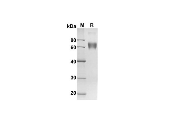 Recombinant Human CD200 Protein( Fc Tag) (RPES8282)