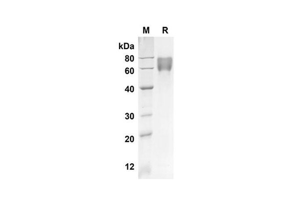 Recombinant Human F9 Protein (His Tag) (RPES8307)